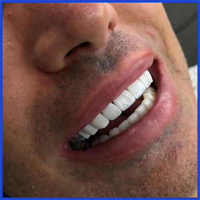 نمونه کار بعد