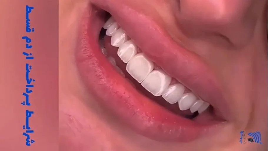 نمونه کار