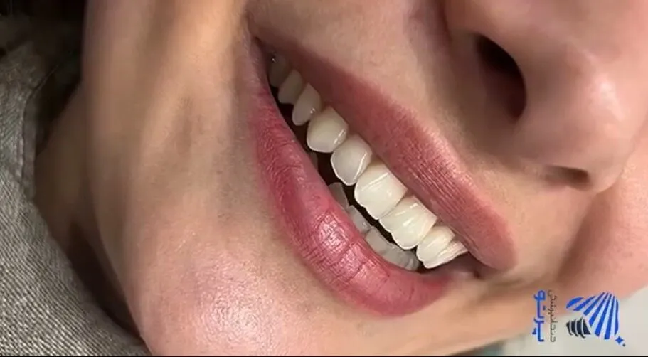 نمونه کار