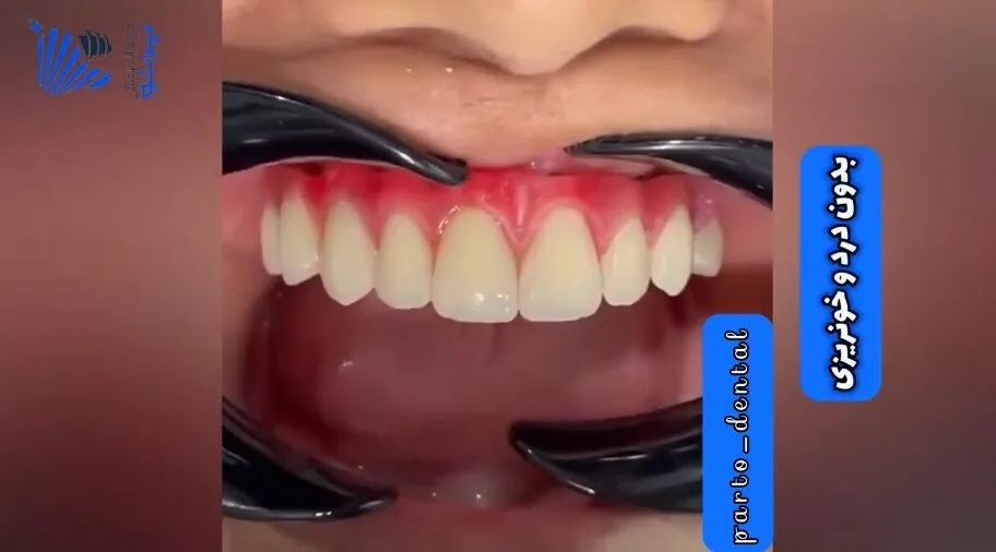 نمونه کار
